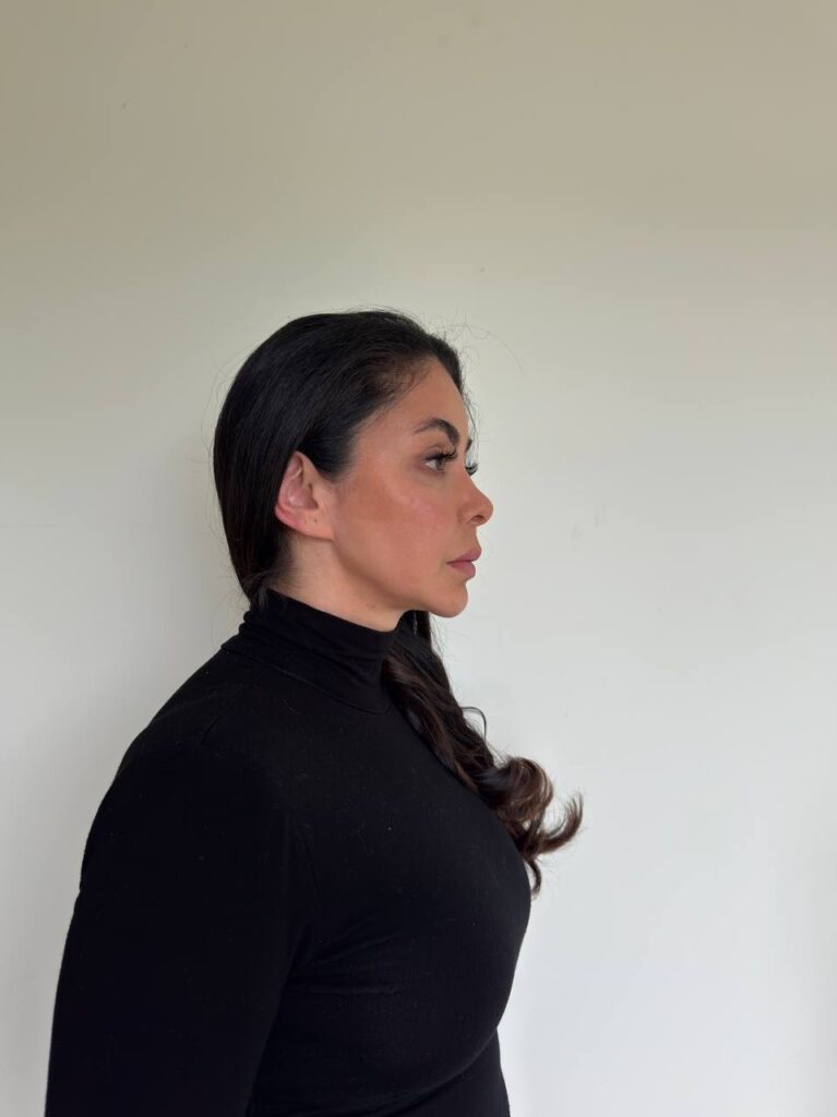 Right Profile