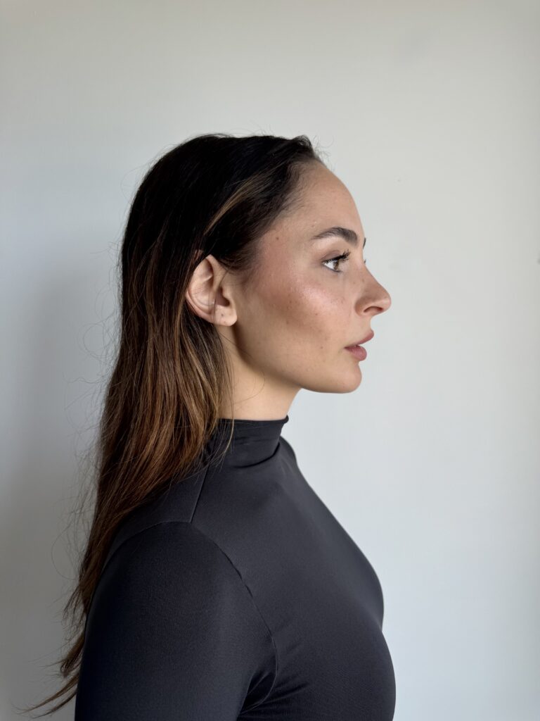 Right Profile
