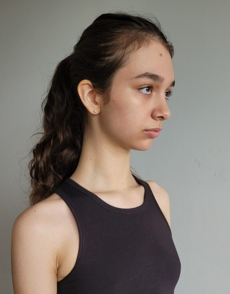 Right Profile