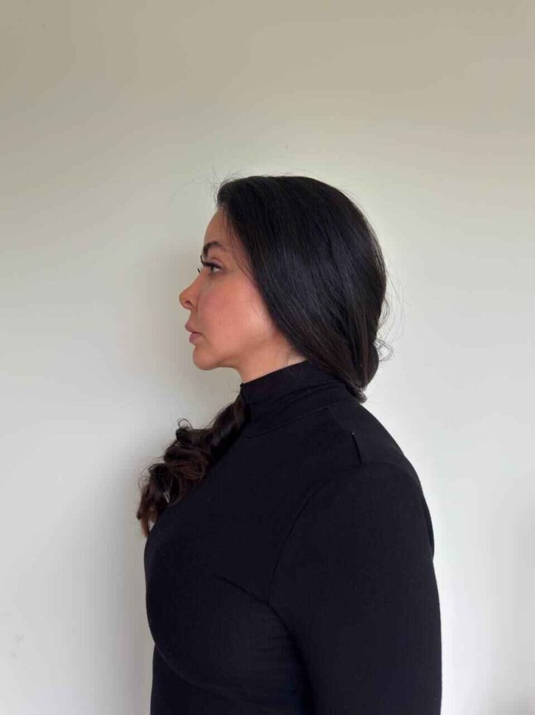 Left Profile