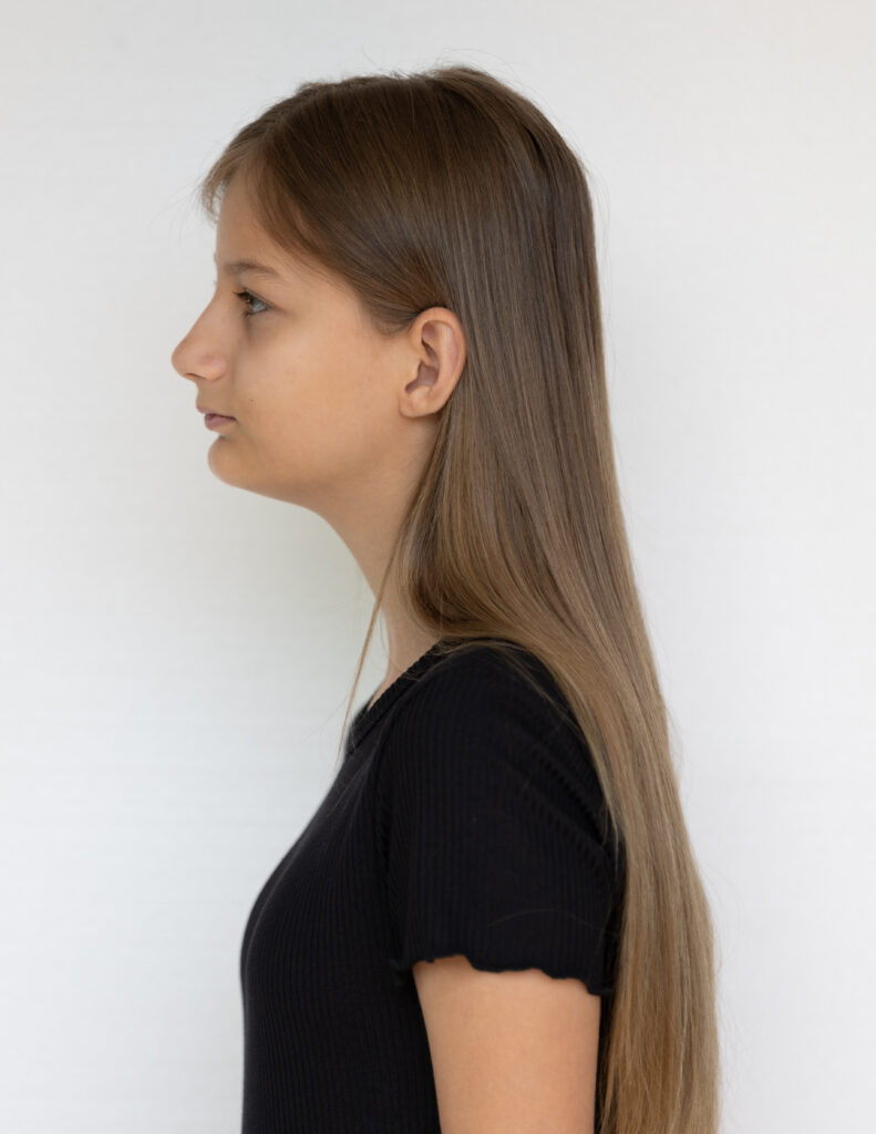 Left Profile
