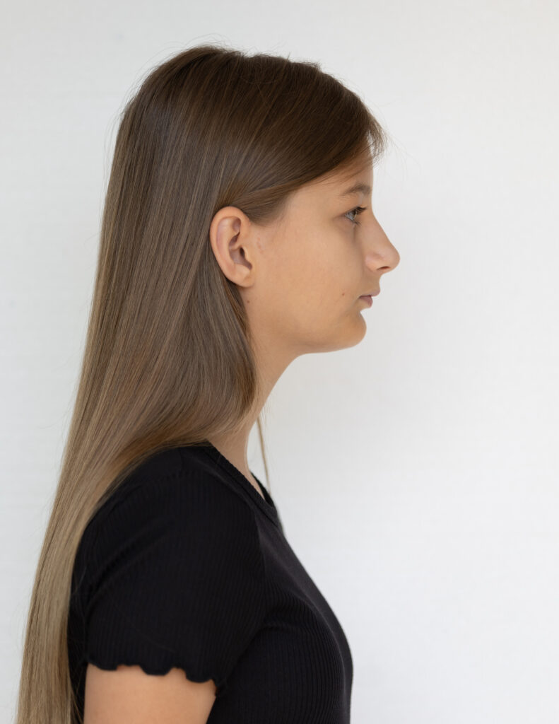 Right Profile